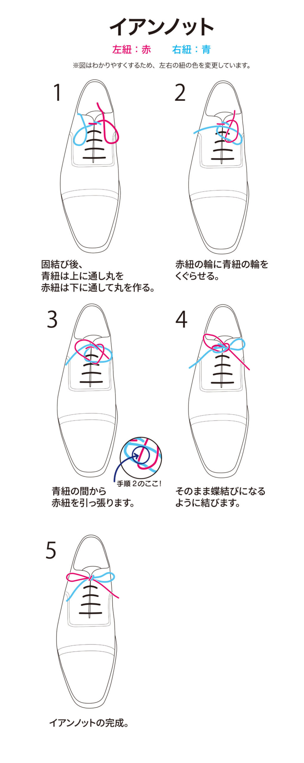 イアンノット